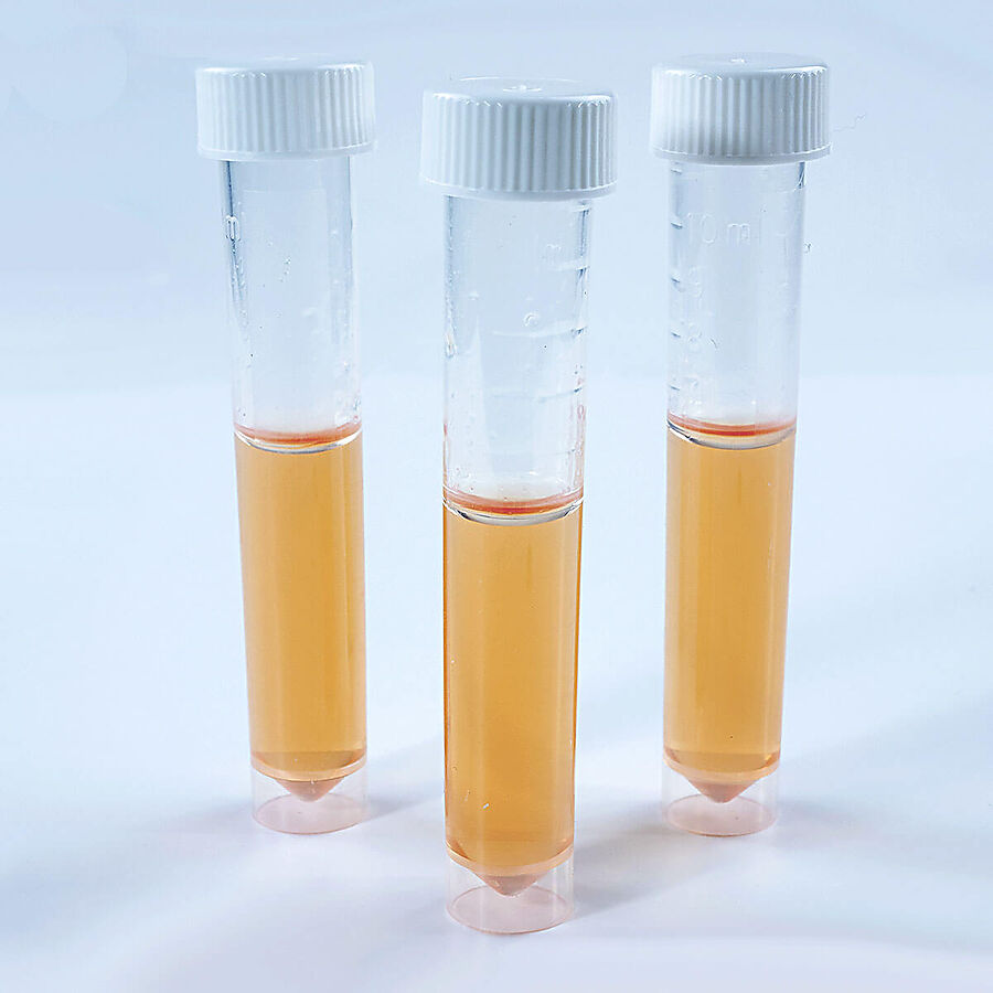 NRB TUBE FOR DENITRIFYING BACTERIA